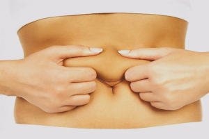  Bagaimana untuk mengetatkan kulit pada abdomen selepas bersalin